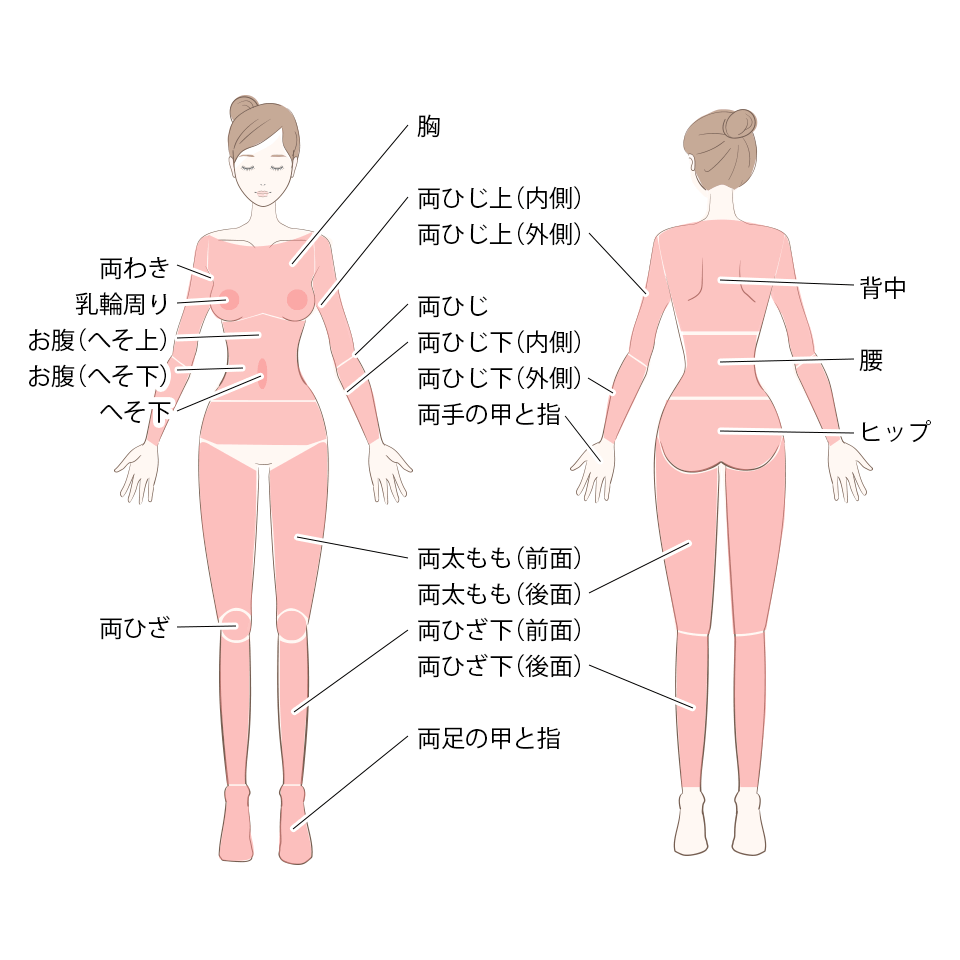 医療脱毛の対象部位（ボディ）