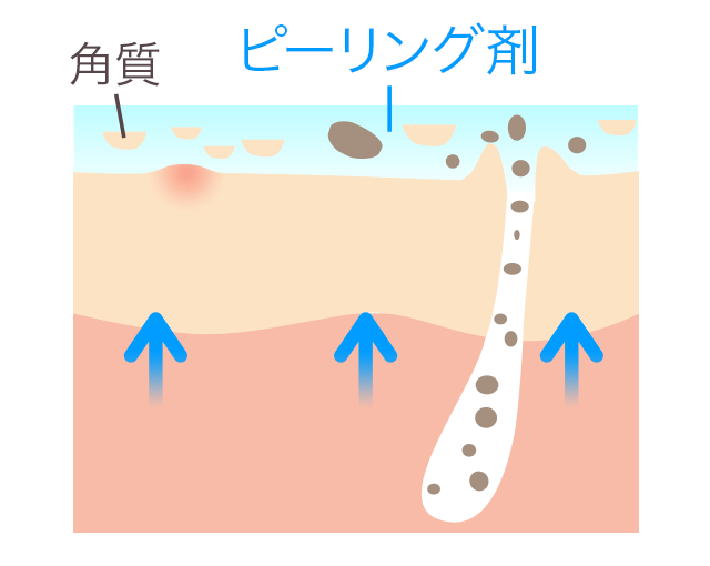 ケミカルピーリング剤を塗布した肌