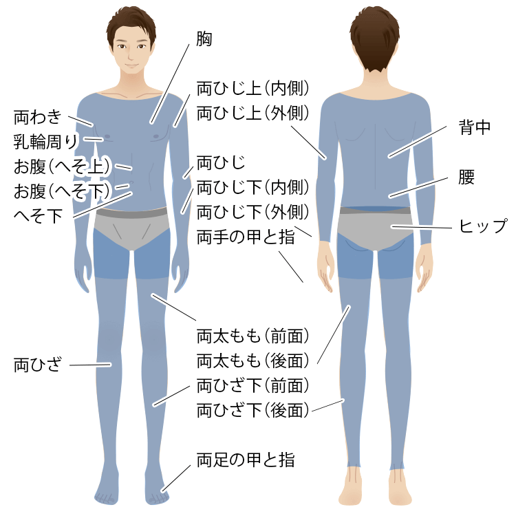 医療脱毛の対象部位（ボディ）