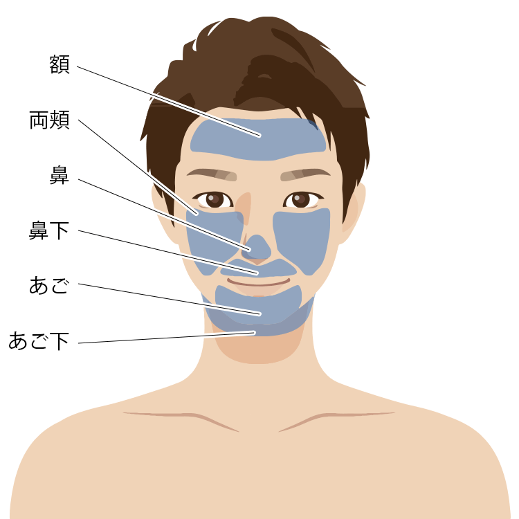 医療脱毛の対象部位（顔）