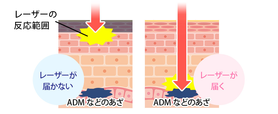 事前準備が必要な理由の図解