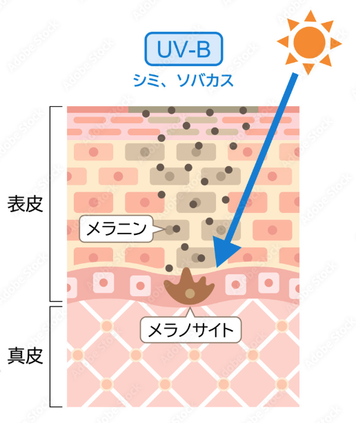 シミができるまで