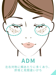 ADM