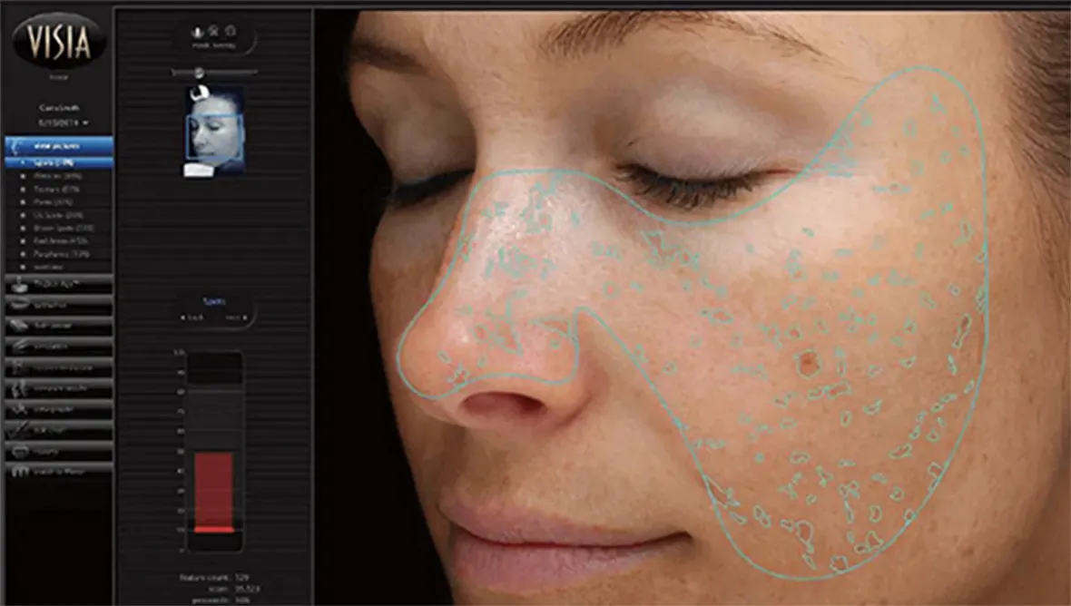 1.シミ解析機能