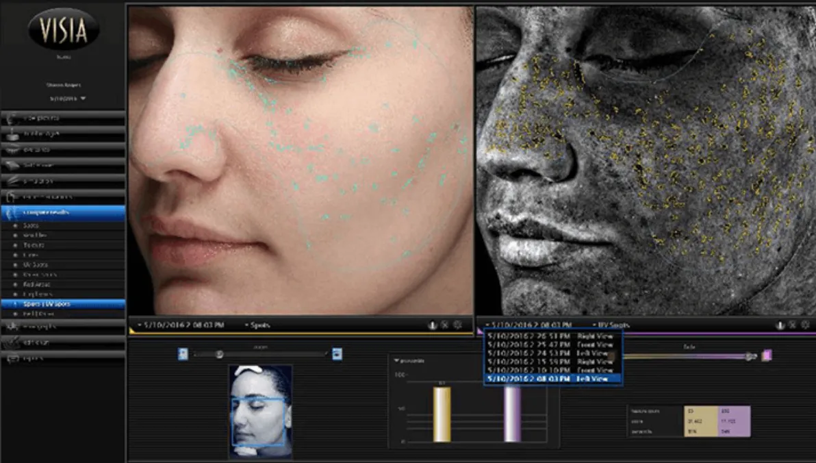 画像の同時比較機能