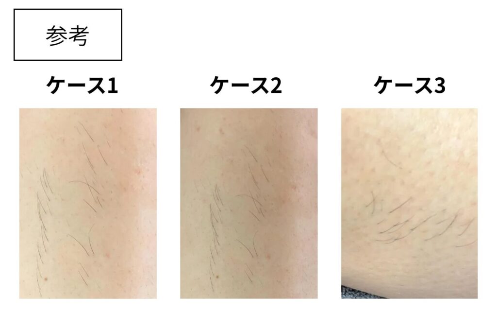線状やかたまりで毛が残っている