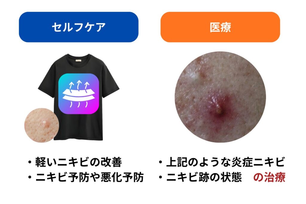 セルフケアと医療の役割