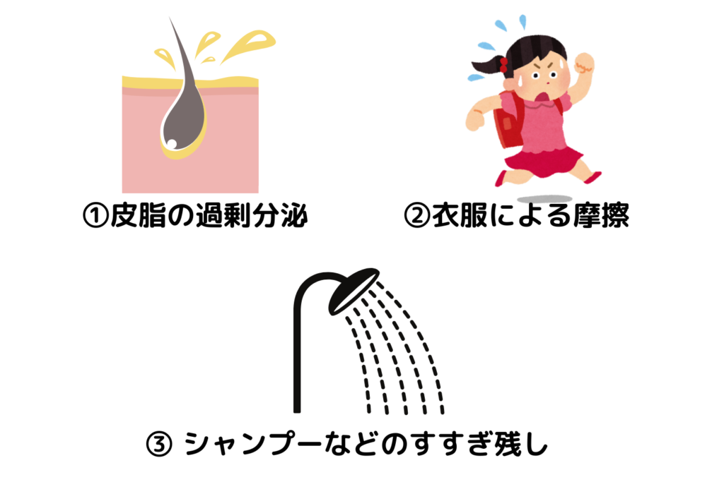 背中ニキビができる理由