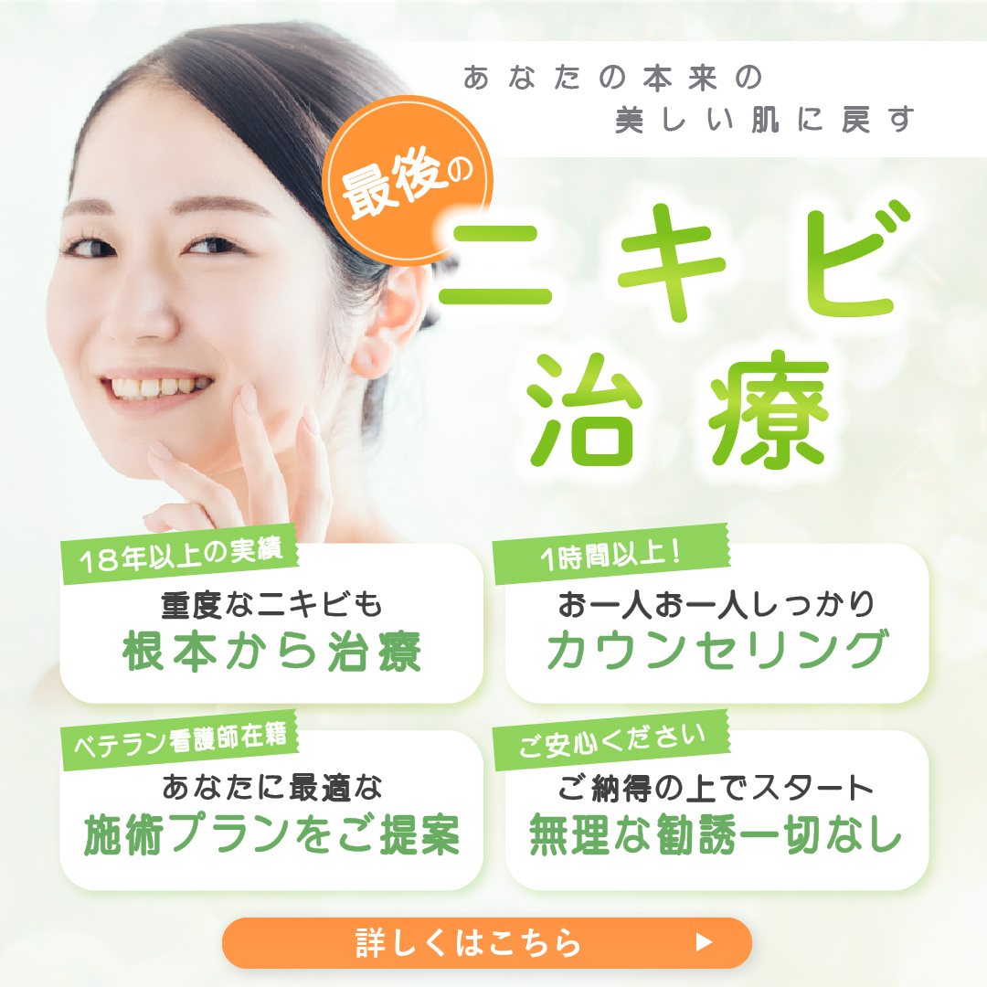 ニキビ治療