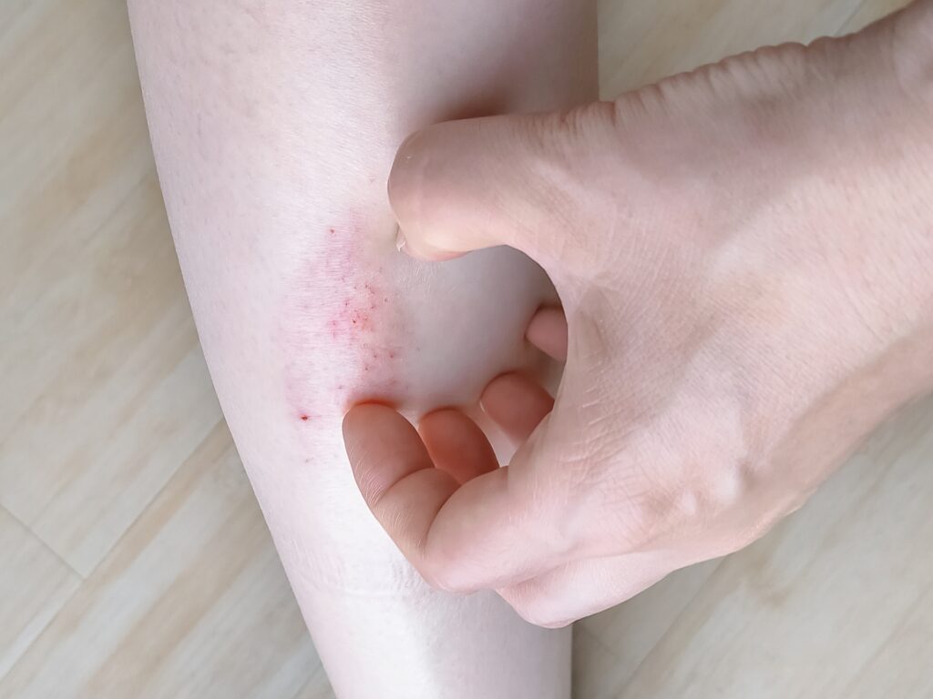 肌や体が弱っているときは刺激を避ける