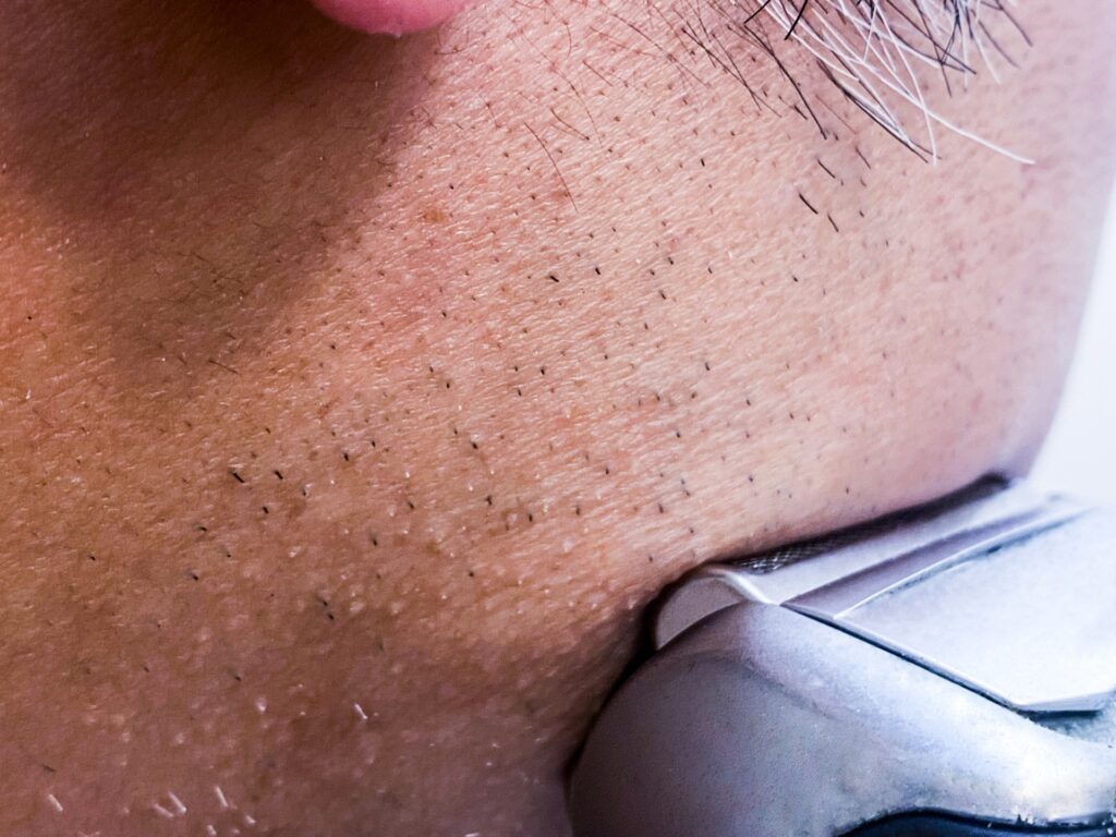 硬毛化の定義とは?