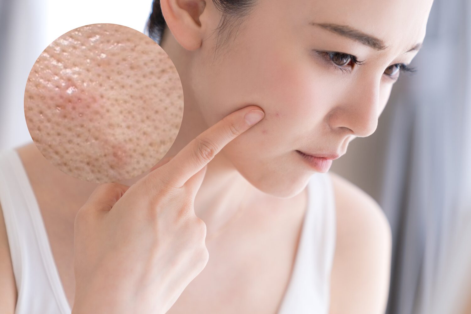 脱毛後の毛嚢炎を早く治す方法と予防のコツ