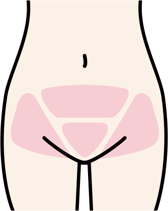 VIOや脇など毛の濃い部分は回数が必要