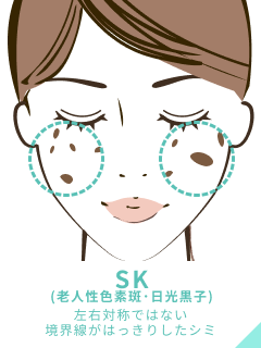 重症の方