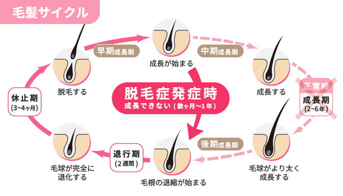 毛髪サイクル図解