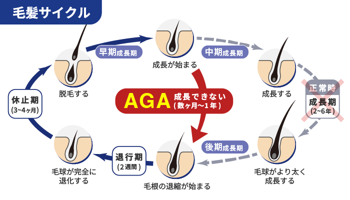 毛髪サイクル