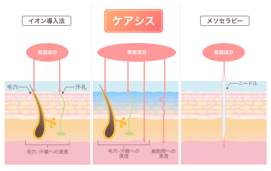 図解 ケアシス