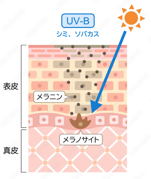 シミ図解