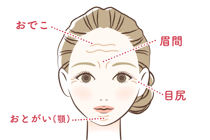 表情しわの治療法図解