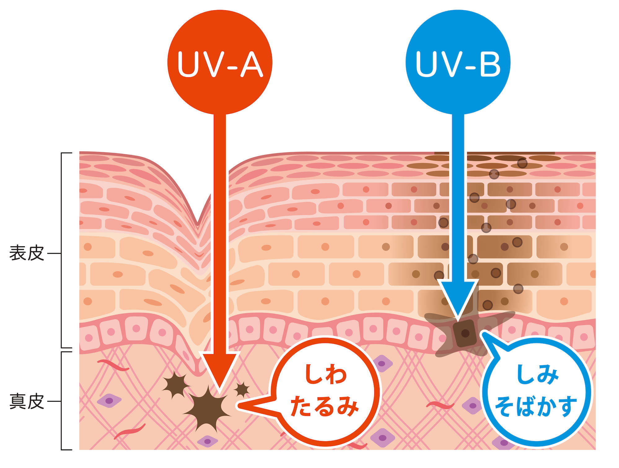 図解 たるみとは