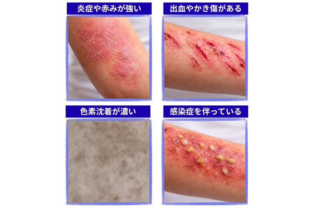 照射を避けた方がよい肌状態