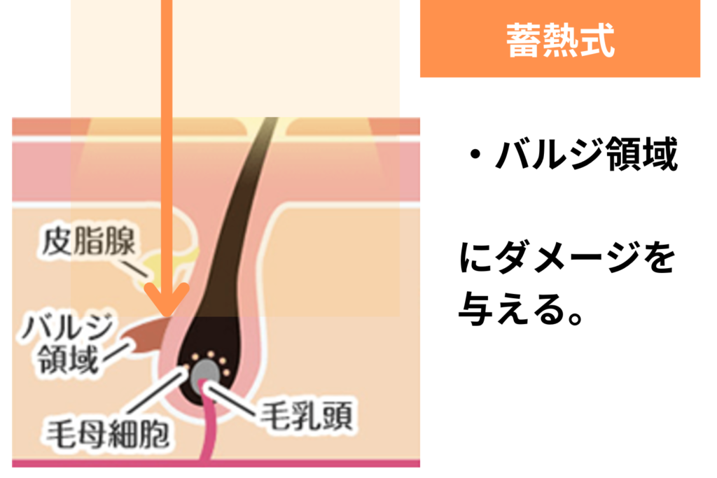蓄熱式の仕組み