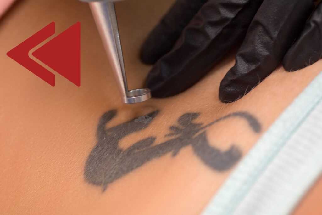 タトゥーを入れる前に脱毛を済ませる