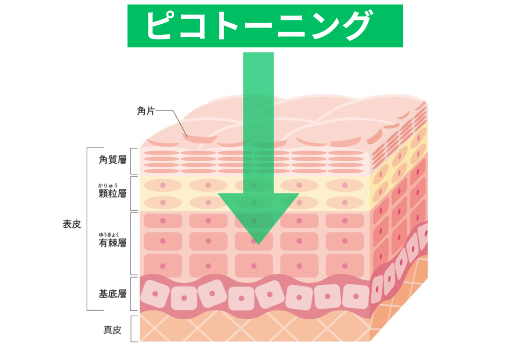 ピコトーニング