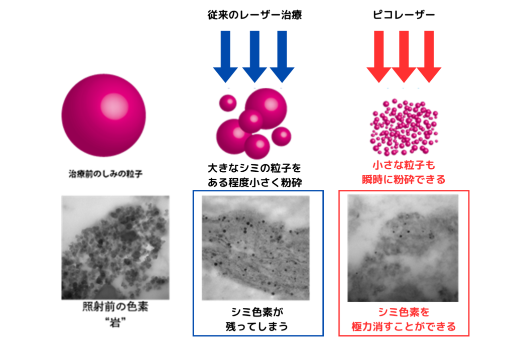 少ない治療回数で効果が期待できる
