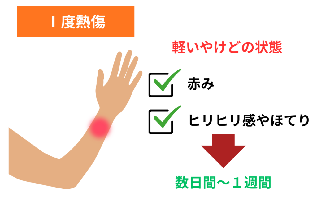 Ⅰ度熱傷：赤みと火照り（数日〜1週間）