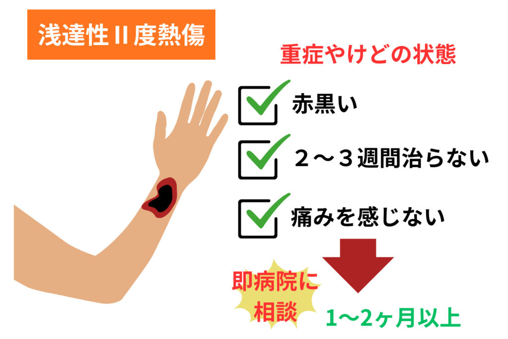 深達性Ⅱ度熱傷：色素沈着・痕が残るリスク（1〜2ヶ月以上）