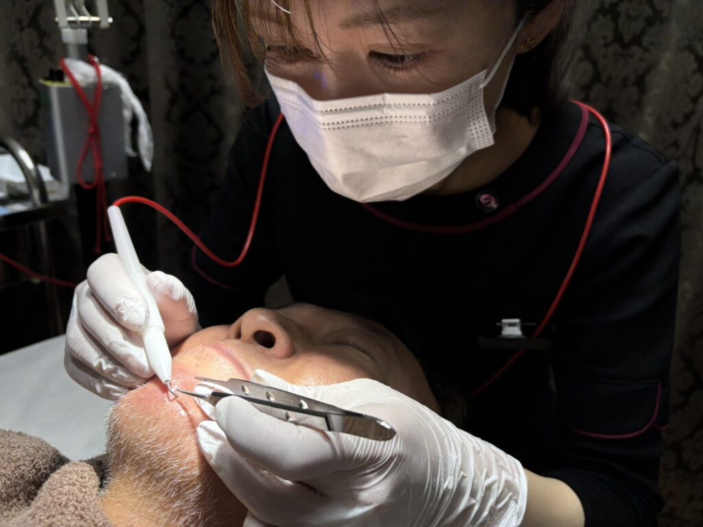 肌治療64,000件の確かな実績