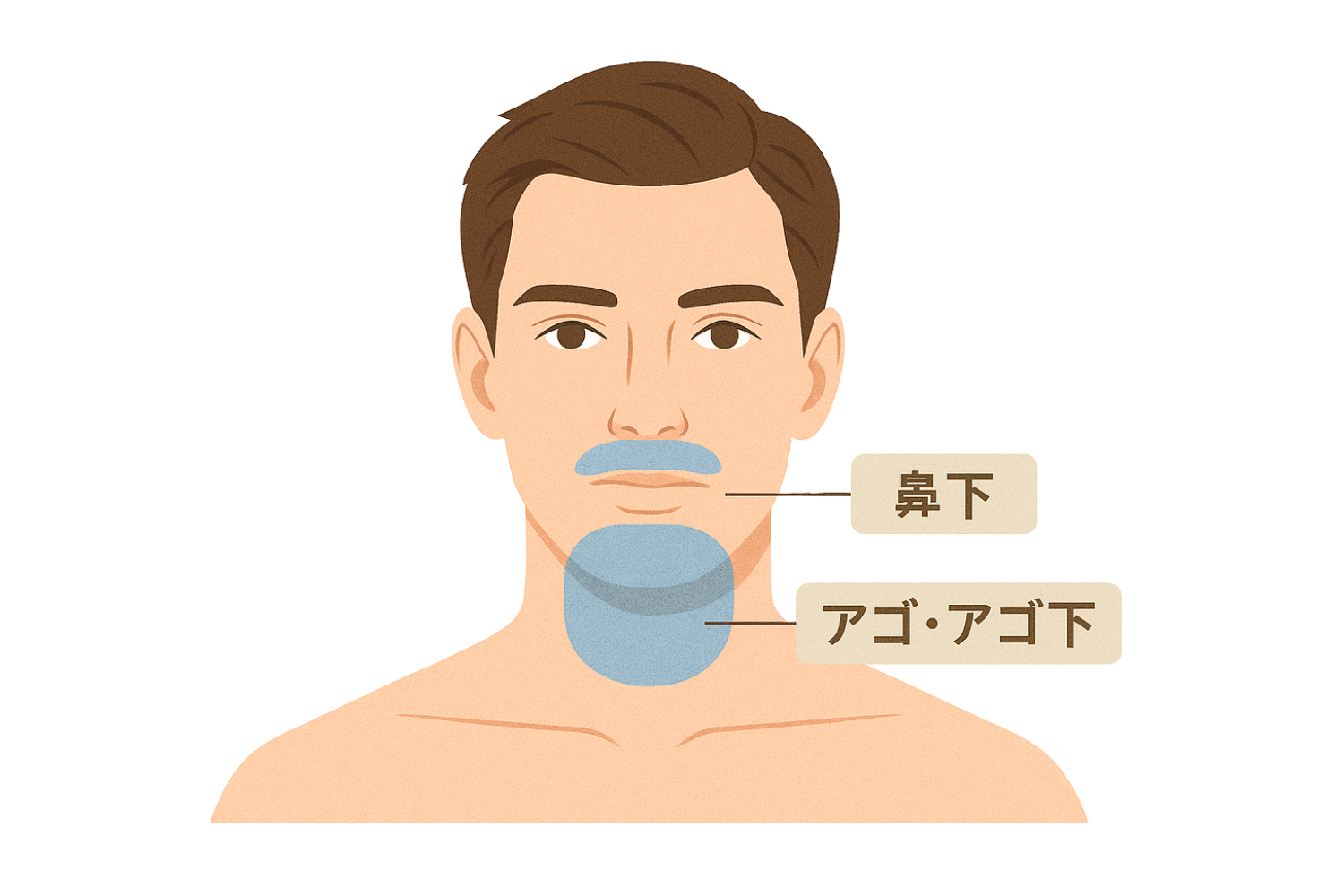 ヒゲ脱毛