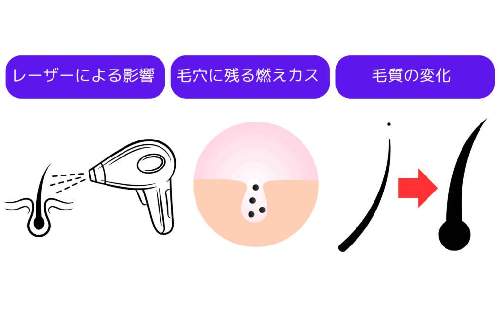 泥棒ヒゲの原因