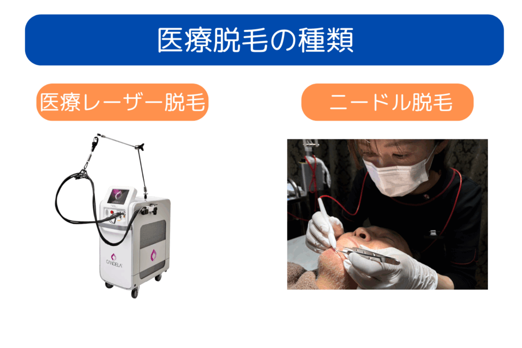 医療脱毛の種類