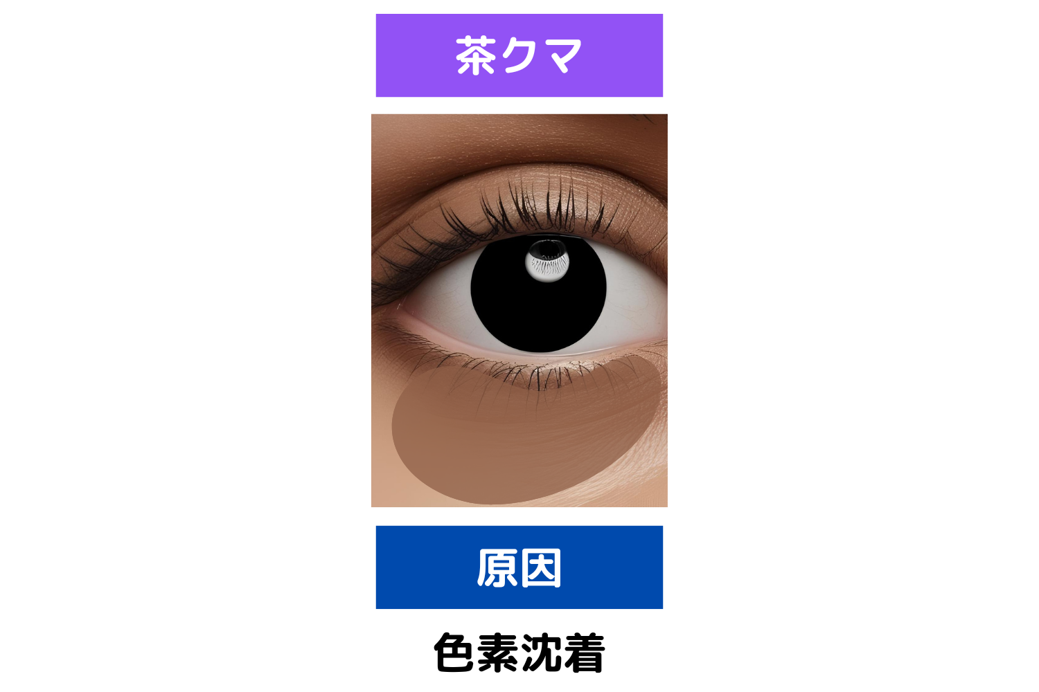 茶クマ:目元をこすりがち方