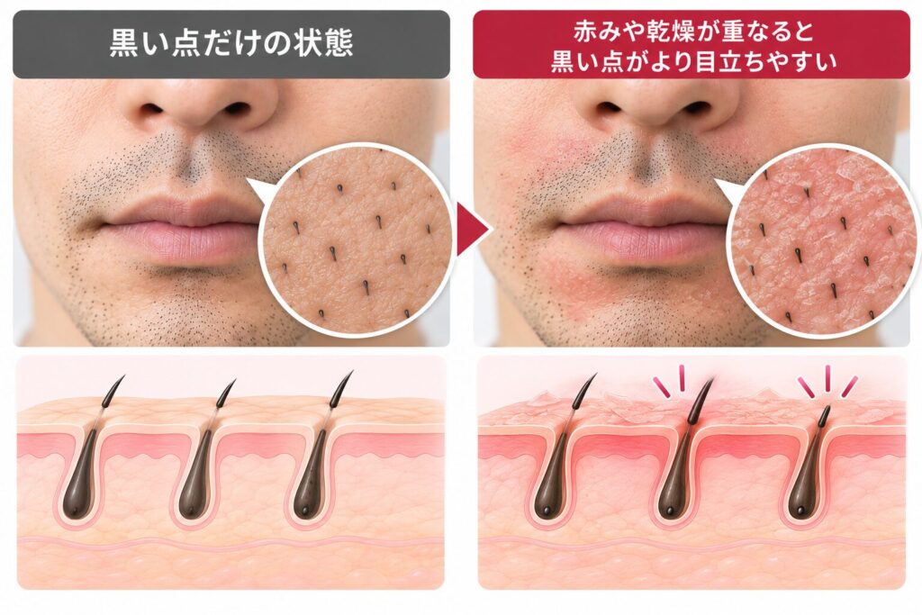 乾燥や炎症があると、抜け落ちるまで長引きやすい