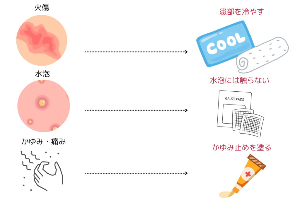 万が一やけどした場合の対処法