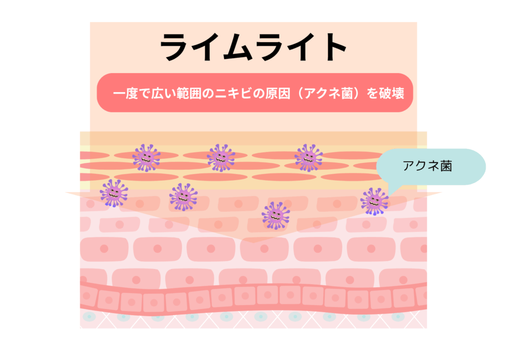 ライムライト