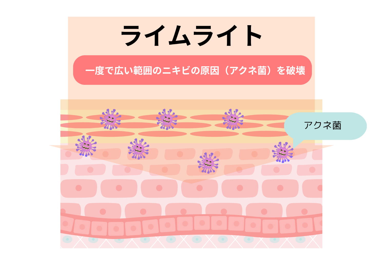 ライムライト