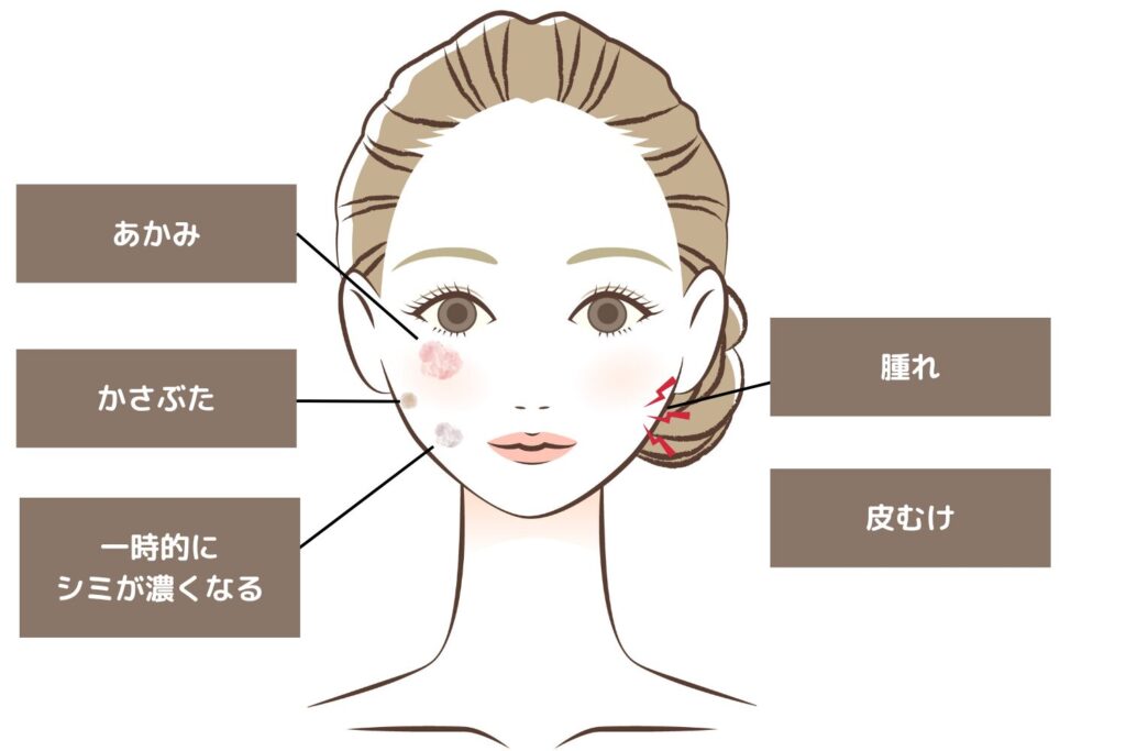 ダウンタイムの症状とその理由