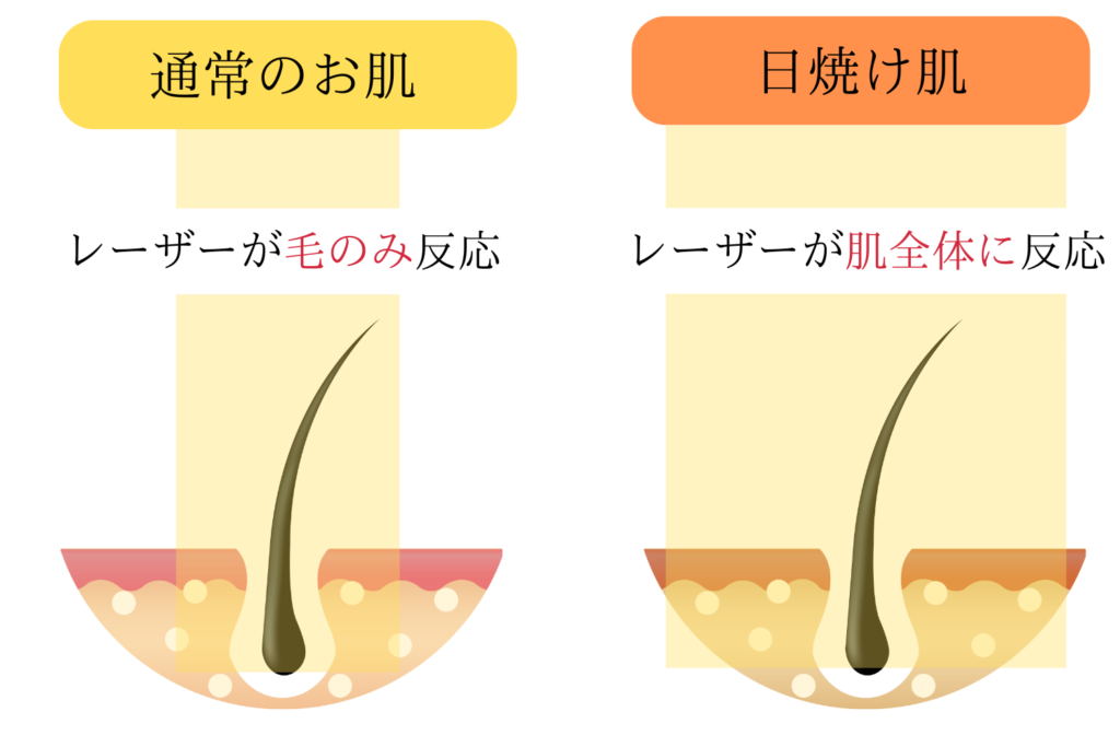 火傷など肌トラブルのリスクが高まる