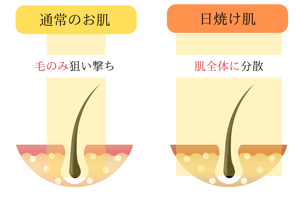 脱毛効果が大幅に低下する