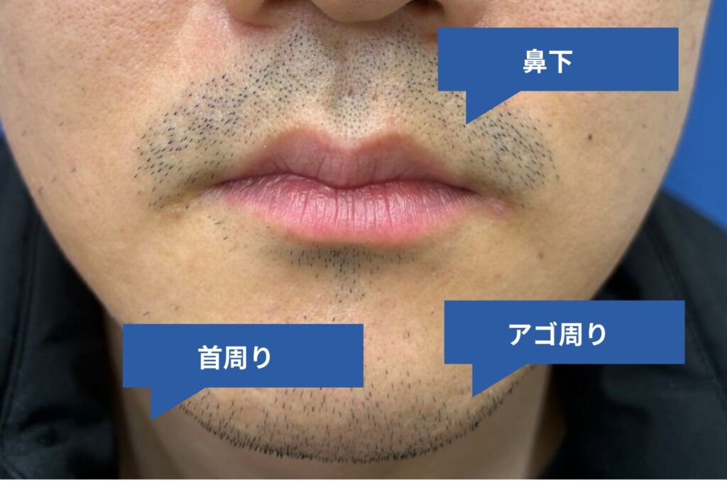 5．部位による効果の違い