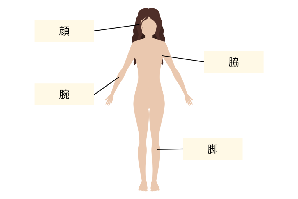 VIO以外なら施術可能なケースも