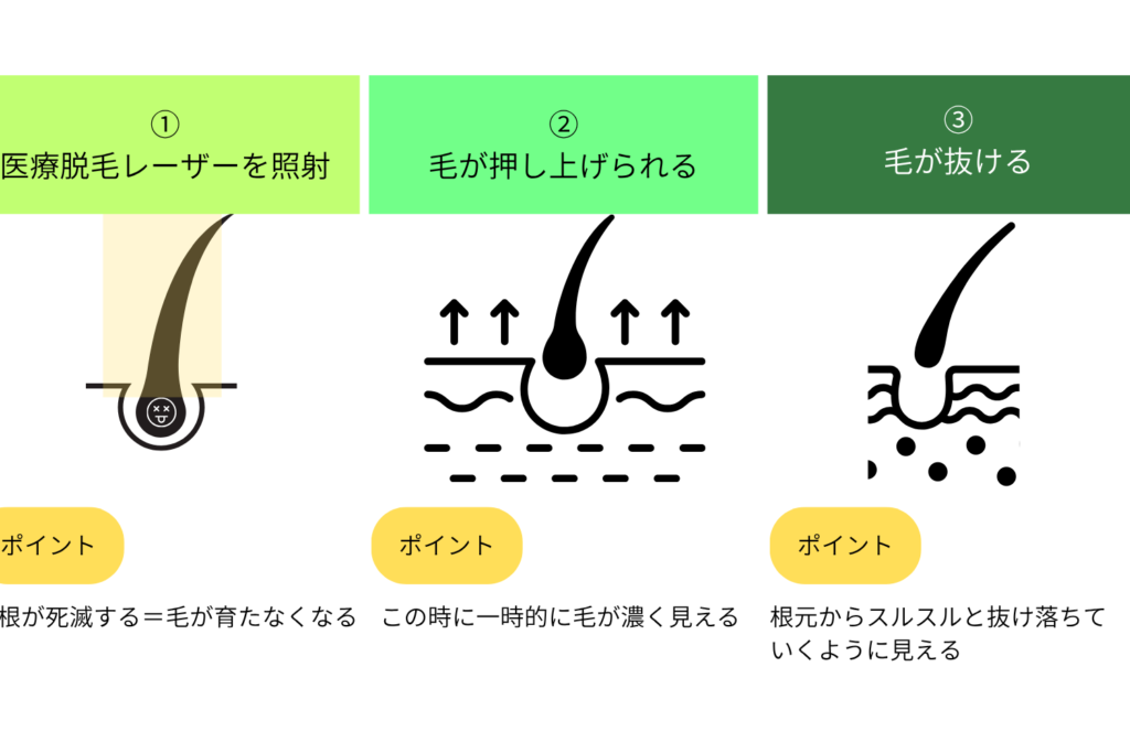 ポップアップ現象のメカニズム