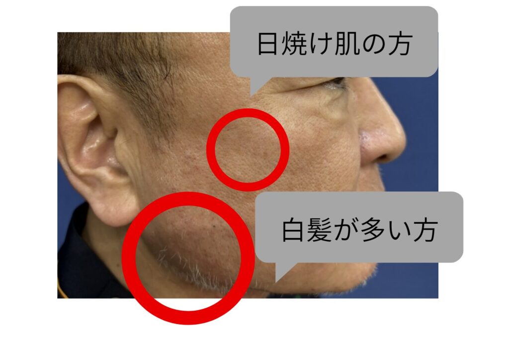 毛質や肌質