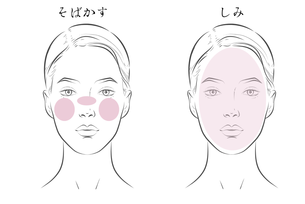 部位や分布で見極める