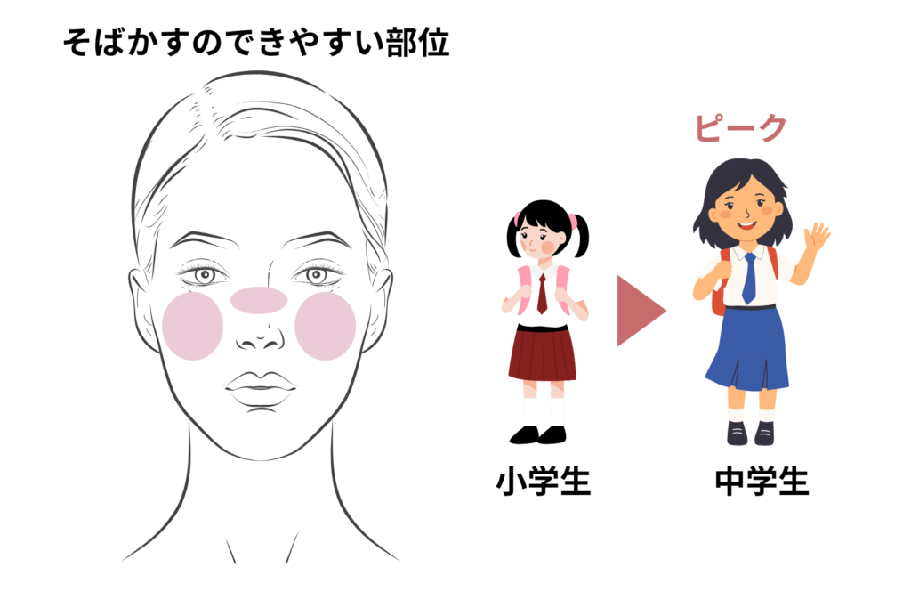 発症年齢と部位の傾向