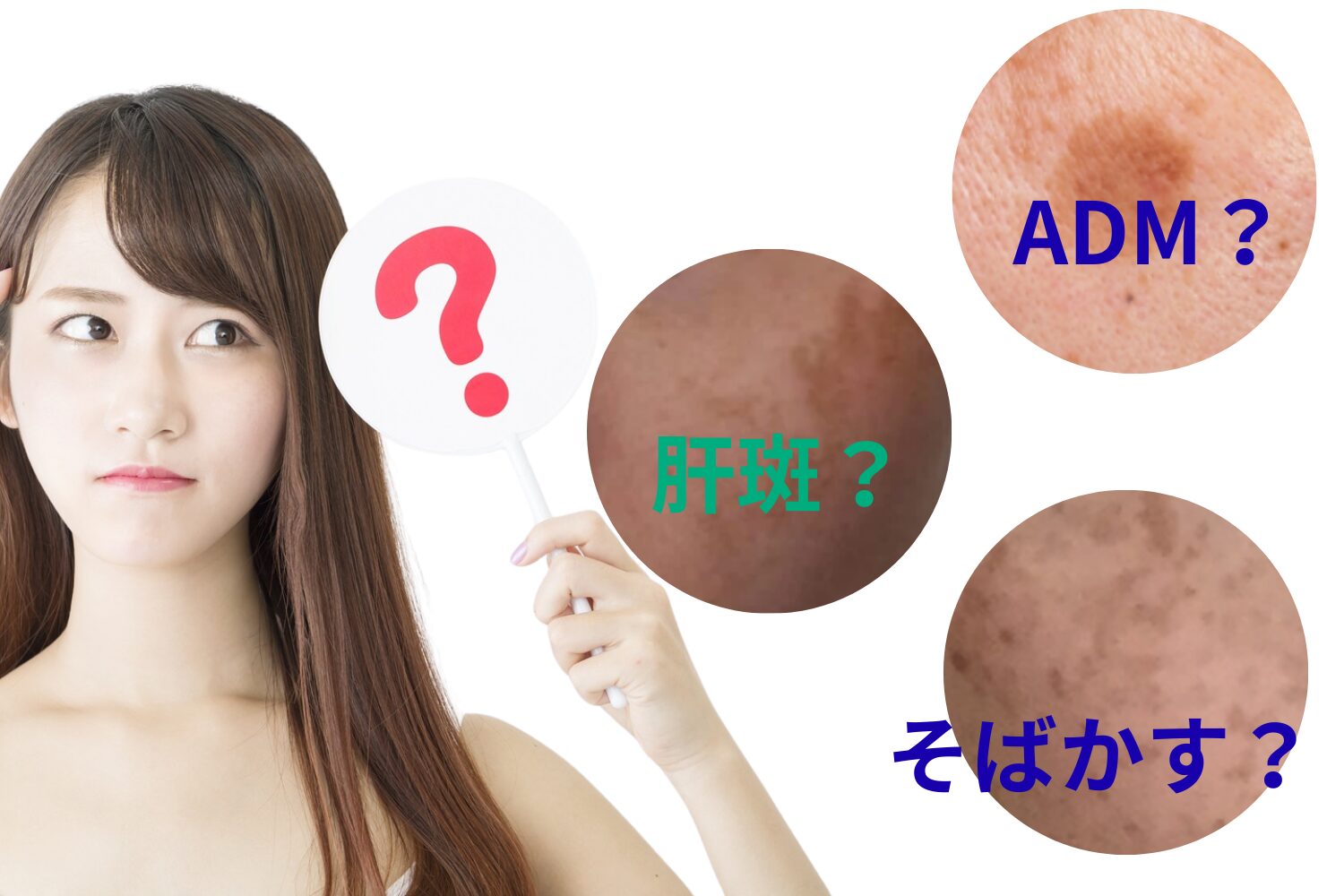 【最新】シミ取り治療の種類と選び方｜レーザー・光治療・内服薬・外用薬まで徹底解説